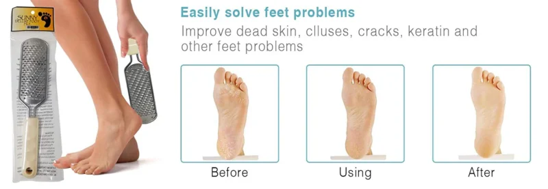 A Sunny Deluxe Foot File Replacement with Sunny Deluxe Foot File Replacement packaging on the left. Three images on the right show a foot before use (dry and cracked), during use (being filed), and after use (smooth). Text: "Easily solve feet problems.